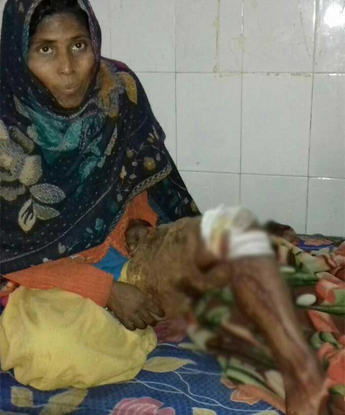 तेंदुए के हमले में घायल  हजरुन्निशा 