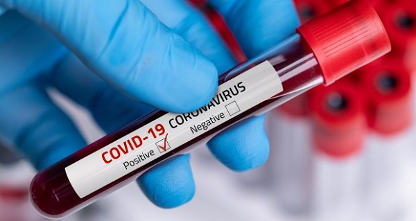 CRPF के जवानों में कोरोना संक्रमितों की संख्या बढ़ी (फाइल फोटो)
