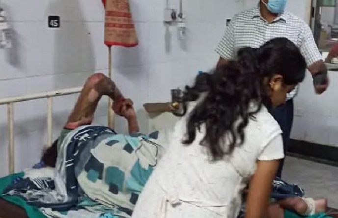 दुमका में इनकार पर 12वीं की छात्रा को जिंदा जलाया