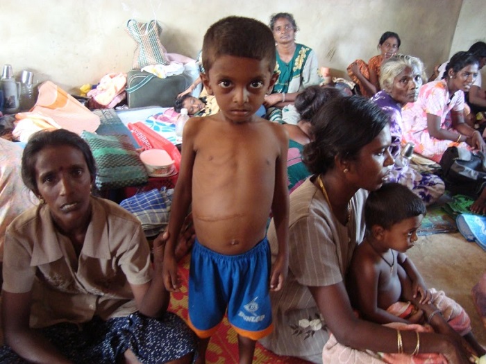 मध्य प्रदेश में जनवरी से मार्च तक लगभग 78,000 बच्चे कुपोषित